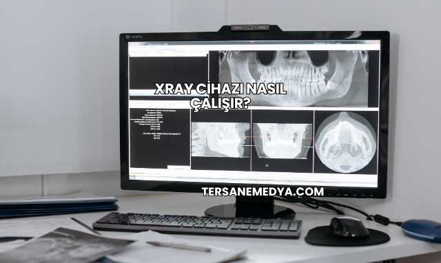 Xray Cihazı Nasıl Çalışır?